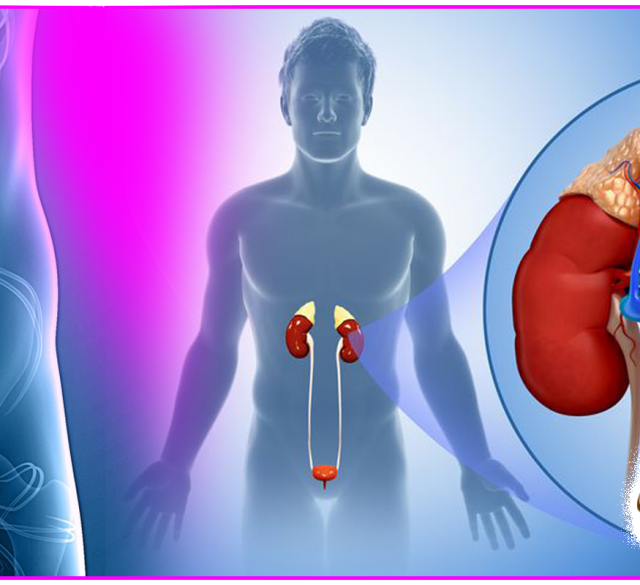 جراحی باز پروستات